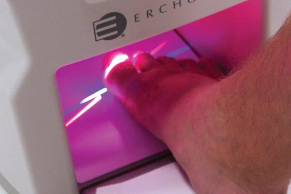 Lunula laser treatment