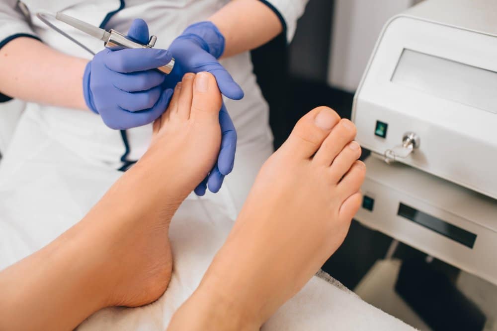 Lunula laser solution for toenail fungus